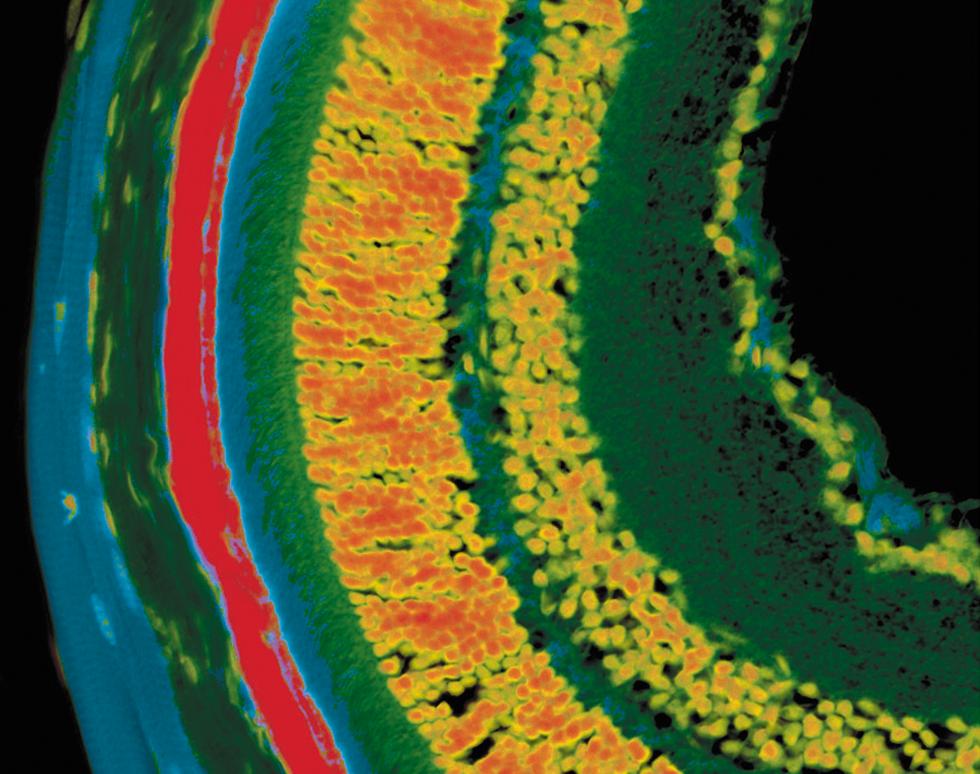 Murine Retina - Sonya Martin